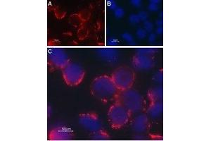 Immunocytochemistry (ICC) image for anti-Transient Receptor Potential Cation Channel, Subfamily C, Member 6 (TRPC6) (AA 573-586), (Extracellular) antibody (ABIN7043825)