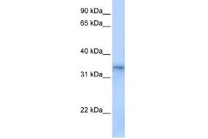 WB Suggested Anti-FHL5 Antibody Titration:  0. (FHL5 antibody  (Middle Region))