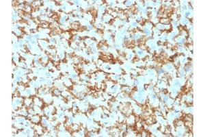Formalin-fixed, paraffin-embedded human Histiocytoma stained with CD163 Mouse Monoclonal Antibody (M130/1210). (CD163 antibody  (AA 43-196))