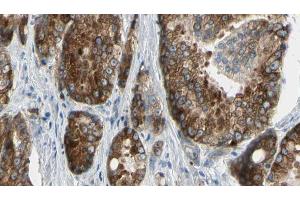 ABIN6273377 at 1/100 staining Human prostate tissue by IHC-P. (ATP12A antibody  (N-Term))