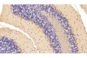 Detection of NME1 in Mouse Cerebellum Tissue using Polyclonal Antibody to Non Metastatic Cells 1, Protein NM23A Expressed In (NME1) (NME1 antibody  (AA 6-147))