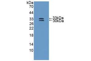Western blot analysis of recombinant Human SOD3. (SOD3 antibody  (AA 19-240))