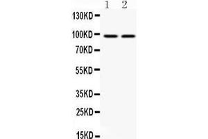 Anti- AHR Picoband antibody, Western blotting All lanes: Anti AHR  at 0.
