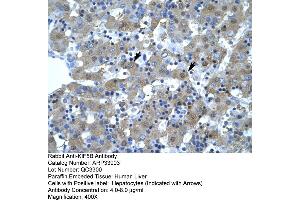 Human Liver (KIF5B antibody  (N-Term))