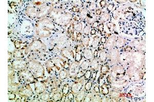 Immunohistochemical analysis of paraffin-embedded human-kidney, antibody was diluted at 1:200 (L1CAM antibody  (AA 151-200))