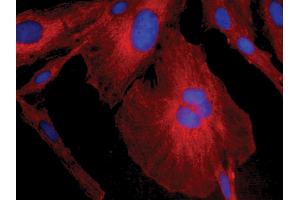 Human astrocytoma cell line CCF-STTG1 was stained with Mouse Anti-Human GFAP-CY3 and DAPI. (GFAP antibody  (Biotin))