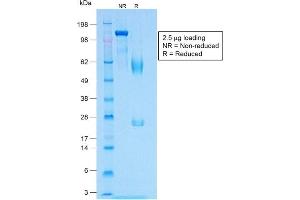 SDS-PAGE Analysis of Purified MART-1 Rabbit Recombinant Monoclonal Antibody (MLANA/1409R). (Recombinant MLANA antibody)