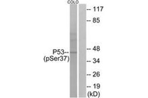 Western blot analysis of extracts from COLO cells, using p53 (Phospho-Ser37) Antibody. (p53 antibody  (pSer37))
