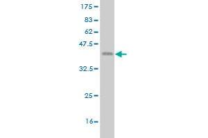 Western Blot detection against Immunogen (37. (ETV1 antibody  (AA 148-257))