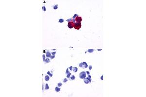 Immunocytochemistry (ICC) staining of HEK293 human embryonic kidney cells transfected (A) or untransfected (B) with PRLHR. (PRLHR antibody  (2nd Extracellular Domain))