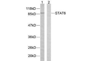 Western blot analysis of extracts from HeLa cells using STAT6 (Ab-645) antibody (E021051). (STAT6 antibody)