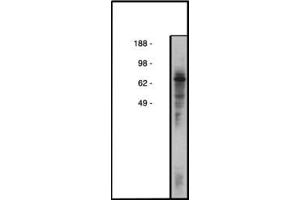 Image no. 1 for anti-Collagen, Type IV, alpha 3 (Goodpasture Antigen) Binding Protein (COL4A3BP) antibody (ABIN793680) (COL4A3BP antibody)