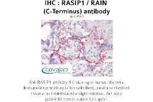 Image no. 1 for anti-Ras Interacting Protein 1 (RASIP1) (C-Term) antibody (ABIN1738746) (RASIP1 antibody  (C-Term))