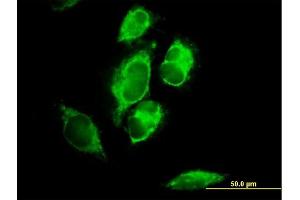 Immunofluorescence of purified MaxPab antibody to MRPL1 on HeLa cell. (MRPL1 antibody  (AA 1-303))