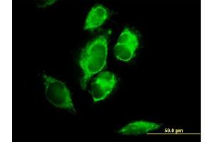 Immunofluorescence of purified MaxPab antibody to MRPL1 on HeLa cell.