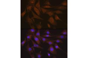 Immunofluorescence (IF) image for anti-Platelet-Activating Factor Acetylhydrolase 1b, Regulatory Subunit 1 (45kDa) (PAFAH1B1) antibody (ABIN7269401)