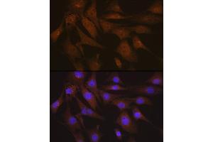 Immunofluorescence analysis of NIH-3T3 cells using LIS1 Rabbit mAb (ABIN7269401) at dilution of 1:100 (40x lens). (PAFAH1B1 antibody)