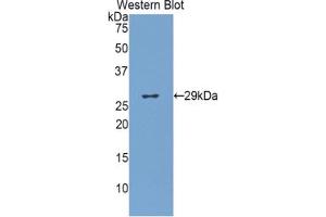 Western blot analysis of the recombinant protein. (Glucuronidase beta antibody  (AA 440-648))