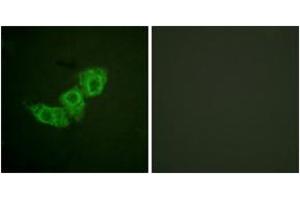 Immunofluorescence analysis of HuvEc cells, using EGFR (Phospho-Thr678) Antibody. (EGFR antibody  (pThr678))