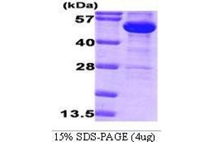 Figure annotation denotes ug of protein loaded and % gel used. (Glucose-6-Phosphate Dehydrogenase Protein (G6PD) (AA 1-491))