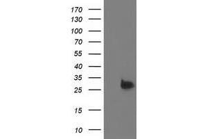 HEK293T cells were transfected with the pCMV6-ENTRY control (Left lane) or pCMV6-ENTRY DTYMK (Right lane) cDNA for 48 hrs and lysed. (DTYMK antibody)