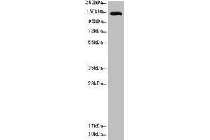 Western blot All lanes: USP28 antibody at 3. (USP28 antibody  (AA 430-580))