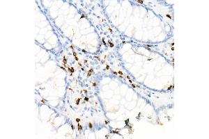 Immunohistochemistry of paraffin-embedded Human colon using CD7 antibody (ABIN7266214) at dilution of 1:10000 (40x lens).