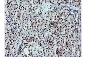Image no. 2 for anti-Tumor Protein P73 (TP73) (AA 167-409) antibody (ABIN1491005) (Tumor Protein p73 antibody  (AA 167-409))