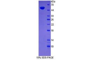 SDS-PAGE (SDS) image for Synaptopodin (SYNPO) (AA 97-300) protein (His tag,GST tag) (ABIN2123630)