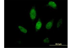 Immunofluorescence of purified MaxPab antibody to FKBP5 on HeLa cell. (FKBP5 antibody  (AA 1-457))