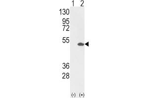 Western Blotting (WB) image for anti-Ets Variant 4 (ETV4) antibody (ABIN3002727) (ETV4 antibody)