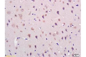 Formalin-fixed and paraffin embedded mouse brain labeled with Rabbit Anti Acylglycerol Kinase Polyclonal Antibody, Unconjugated (ABIN716741) at 1:200 followed by conjugation to the secondary antibody and DAB staining (Acylglycerol Kinase antibody  (AA 335-422))