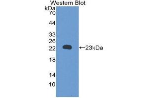 Western Blotting (WB) image for anti-Retinol Binding Protein 5, Cellular (RBP5) (AA 19-201) antibody (ABIN3201813) (Retinol Binding Protein 5 antibody  (AA 19-201))