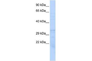 PSMB1 antibody used at 1 ug/ml to detect target protein.