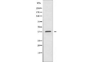 Western blot analysis of extracts from K562 cells, using A4GNT antibody. (A4GNT antibody  (C-Term))