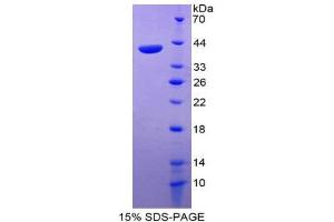 SDS-PAGE (SDS) image for Reelin (RELN) (AA 3142-3460) protein (His tag) (ABIN1878576) (Reelin Protein (RELN) (AA 3142-3460) (His tag))
