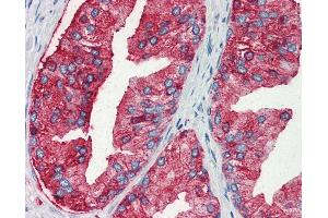 Anti-MUC13 antibody IHC of human prostate. (MUC13 antibody  (Internal Region))