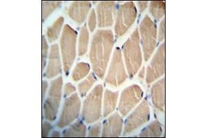 Immunohistochemistry analysis in formalin fixed and paraffin embedded human skeletal muscle reacted with KLHDC1 Antibody (N-term) followed which was peroxidase conjugated to the secondary antibody and followed by DAB staining. (KLHDC1 antibody  (N-Term))