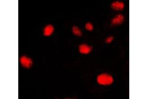 Immunofluorescent analysis of Ku70 staining in HeLa cells. (XRCC6 antibody  (C-Term))