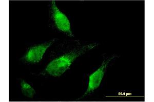 Immunofluorescence of monoclonal antibody to CHD1 on HeLa cell. (CHD1 antibody  (AA 1177-1272))
