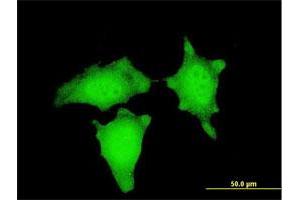 Immunofluorescence of monoclonal antibody to CTNNB1 on HeLa cell. (CTNNB1 antibody  (AA 682-781))