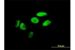 Immunofluorescence of purified MaxPab antibody to ZNF187 on HeLa cell. (ZNF187 antibody  (AA 1-325))