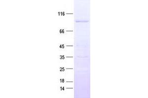 Validation with Western Blot (MARK2 Protein (His tag))