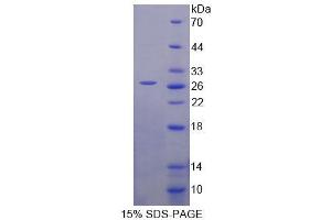 SDS-PAGE analysis of Human HSPA12B Protein. (HSPA12B Protein)