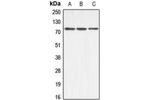 Western blot analysis of ABCB10 expression in HeLa (A), mouse kidney (B), rat kidney (C) whole cell lysates. (ABCB10 antibody  (Center))