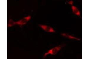 ABIN6275716 staining  Hela cells by IF/ICC. (PSMD6 antibody  (N-Term))