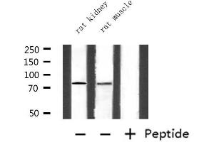 Western blot analysis of extracts from rat kidney and rat muscle, using CEACAM5 Antibody.