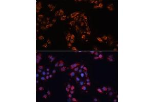 Immunofluorescence analysis of HeLa cells using  antibody (ABIN6129850, ABIN6136348, ABIN6136349 and ABIN6224537) at dilution of 1:100. (ABCB11 antibody  (AA 600-750))