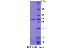 SDS-PAGE analysis of Mouse CISH Protein. (CISH Protein)
