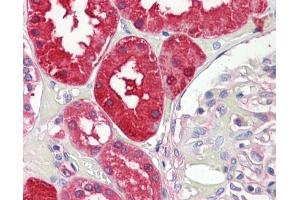 IHC-P Image Aminoacylase 1 antibody [N2C3-2] detects Aminoacylase-1 protein at cytoplasm on human placenta by immunohistochemical analysis. (Aminoacylase 1 antibody)
